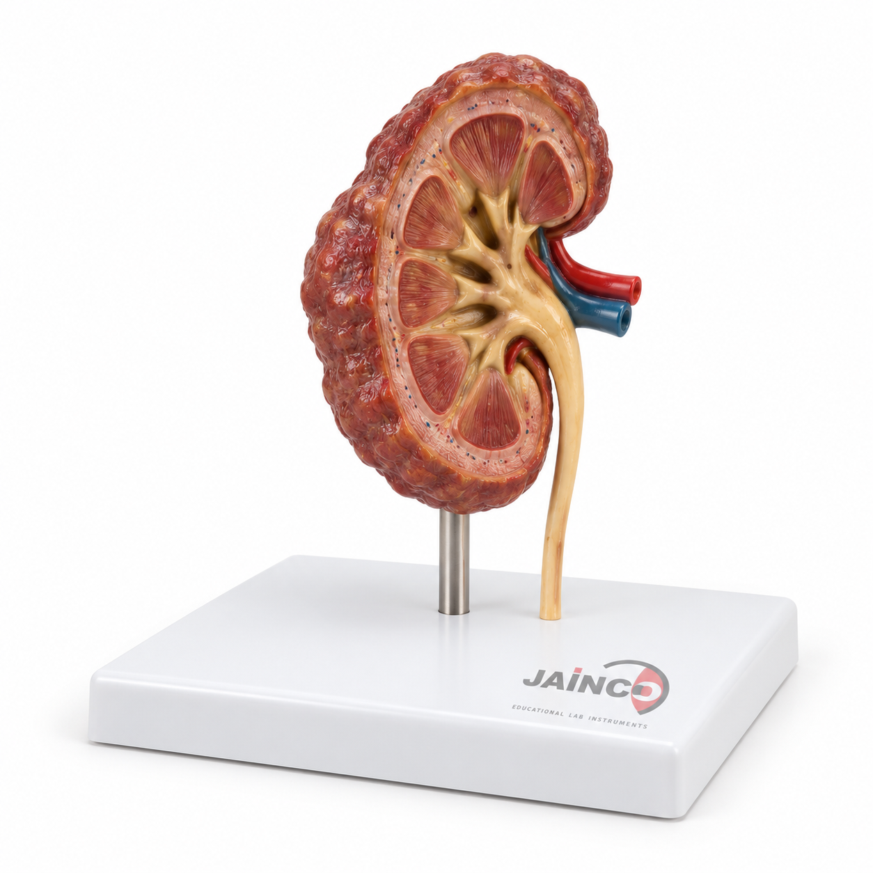 Contracted Kidney Model